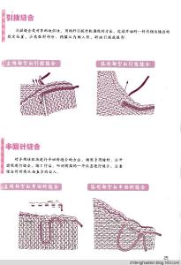 跟腱缝合方法图示 编织常用的缝合技巧,清晰图示一学就会