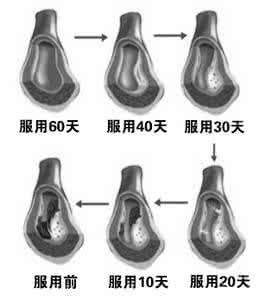 长生不老药 生活中的长生不老药:延寿简直太简单了