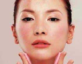 敏感性皮肤如何祛斑 敏感性皮肤如何美白