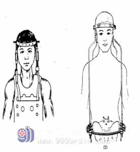 颈源性头痛 日常做到四点 防御“颈源性”头痛很简单