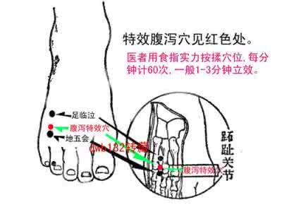 拉肚子止泻点在哪图解 腹泻特效穴