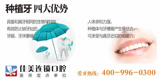 种植牙有什么好处 种植牙有什么好处 种植牙有哪些好处？