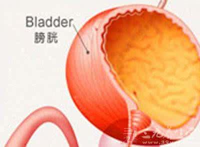 泌尿系感染治疗方法 泌尿系感染的治疗 这些方法可治泌尿系感染