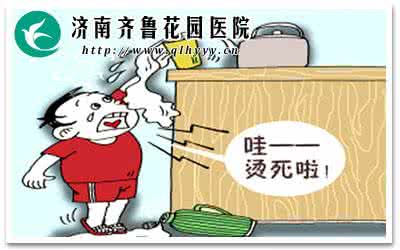 治疗烫伤的偏方 偏方妙招：烫伤急救灵药