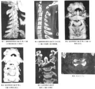 基于变换域的图像配准 基于变换域的CT图像重建