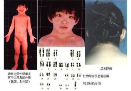 卵泡发育不好的原因 不发育的