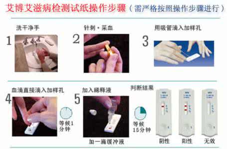 艾滋病属于哪类传染病 艾滋病是属于内科的吗？