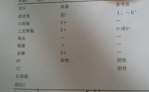 妇科常规检查多少钱 白带常规多少钱一次 妇科常规检查多少钱