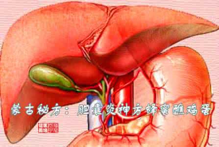 大柴胡汤治疗胆结石 大柴胡汤治疗胆囊炎、胆结石