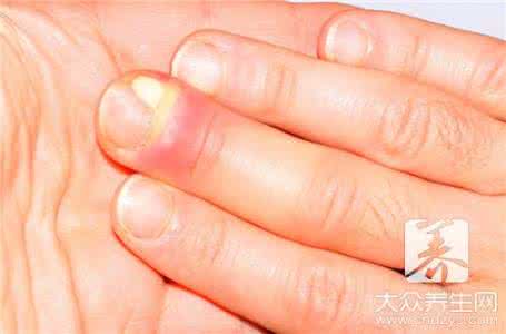 牙龈肿痛食疗 牙龈肿痛怎么办？8个食疗偏方杜绝牙龈上火