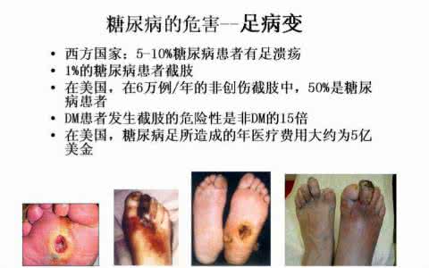 糖尿病的并发症有哪些 糖尿病的各种并发症