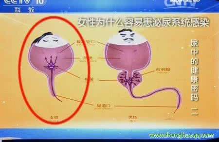 泌尿系感染原因 泌尿系感染 是什么原因导致泌尿系感染