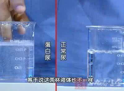 小便频繁量多 正常排尿量是多少