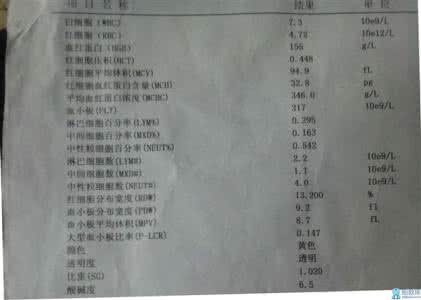 婚检需要取精吗 婚检需要检查精液吗