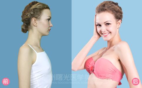 stasy q stasy隆胸直播 隆胸直播