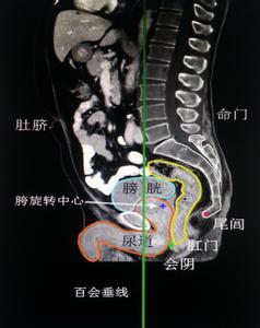 空港地面一线服务 百会至尾闾一线垂直地面