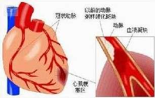 有症状的变时性不良者 心脏变时性功能不全