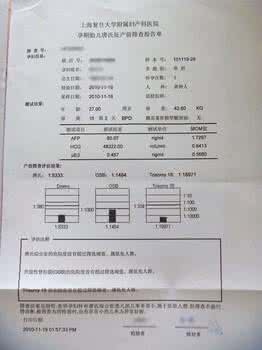 唐氏筛查都有什么项目 唐氏筛查项目有哪些