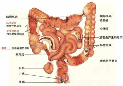 消化系统疾病 第三章 消化系统疾病