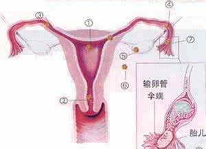宫外孕 宫颈 常识：宫外孕之宫颈妊娠