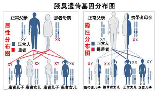 腋臭的最佳治疗方法 腋臭遗传概率是多少 腋臭有哪些治疗方法