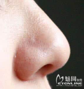 去黑头缩小毛孔的方法 去黑头收紧毛孔的6个高招