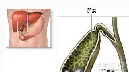 胆内泥沙样结石 治肝胆管泥沙样结石方