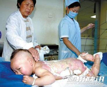 一打喷嚏就尿裤子 2岁半宝宝尿裤子 2岁女童尿裤子遭舅妈喷烫水 11小时后休克死亡