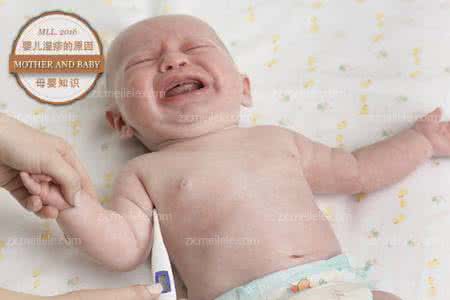 引起婴儿湿疹的原因 引起婴儿湿疹的原因及护理方法