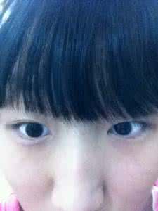 巴哥犬两眼间发红 两眼发红 月经期为何两眼发红