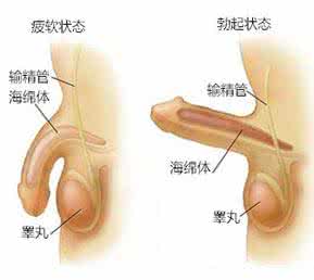 勃起很快变软怎么办 勃起怎么变软？