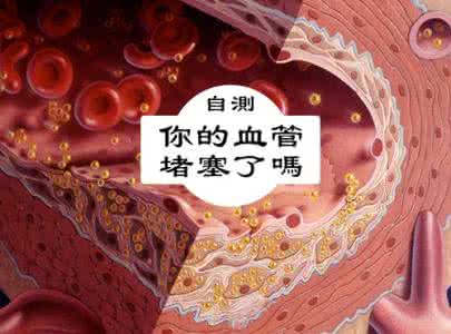 脑血管堵塞的症状 血管是如何一天天堵塞的 看完吓一跳 图