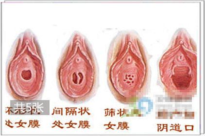 粉红色的火烈鸟 性器官粉红色就一定是处女吗