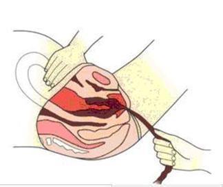 产后出血 产后出血对产妇身体的影响