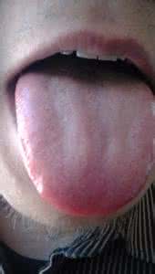 胡子是金色的怎么回事 我的胡子怎么是金色的？