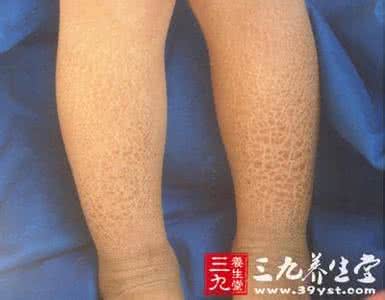 艾滋病离开人体 人体有艾滋病“警报器”