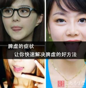 脾虚的症状 脾虚的症状 让你快速解决脾虚的好方法