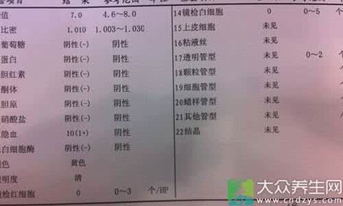 尿检有隐血是什么病 尿检隐血 尿检隐血是什么原因