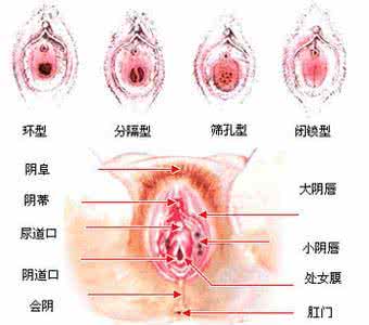 外阴瘙痒红肿用啥药膏 孕期外阴瘙痒 注意 孕期外阴瘙痒怎么回事