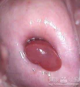 刚怀孕吃什么比较好 怀孕可以吃夏枯草吗?怀孕吃什么比较好