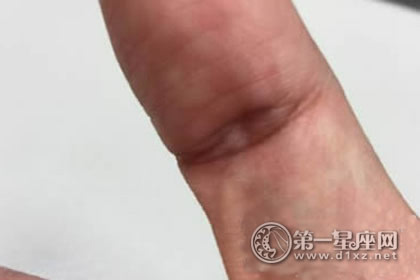 左手拇指有佛眼 左手拇指有佛眼 左手拇指上有佛眼的人，不简单！你有吗?