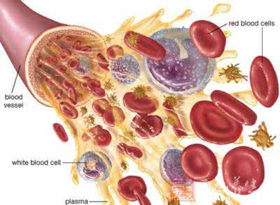 血友病症状 什么是血友病 血友病的症状与治疗