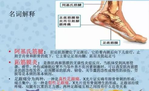 足跟痛症的防治 足跟痛的防治
