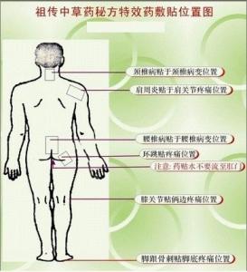 颈肩腰腿痛膏药 颈肩腰肢痛疾病的外敷膏药及其制备方法