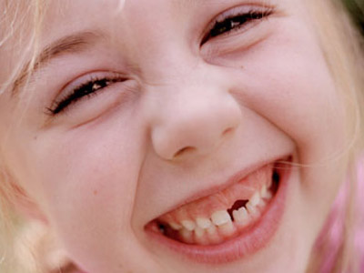 脸部红血丝 睡觉磨牙影响脸部美观 红血丝影响美观,我们该怎么办？