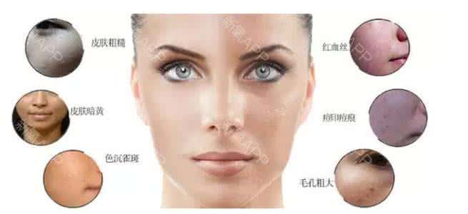 光子嫩肤是什么原理 光子嫩肤原理 光子嫩肤的原理是什么