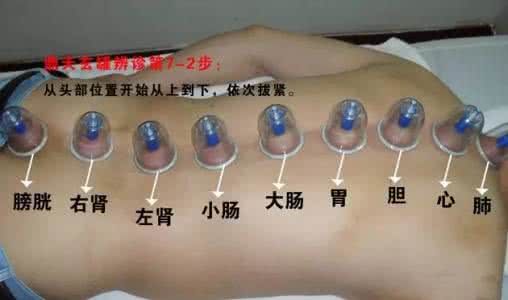 拔罐印记颜色与疾病 拔罐后皮肤的颜色和疾病有什么关系？是寒？是瘀？还是湿？