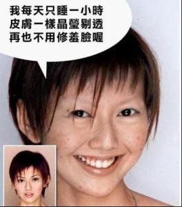 脸上长水痘怎么办 出水痘要注意什么 长痘的脸显脏,再不注意就晚了!