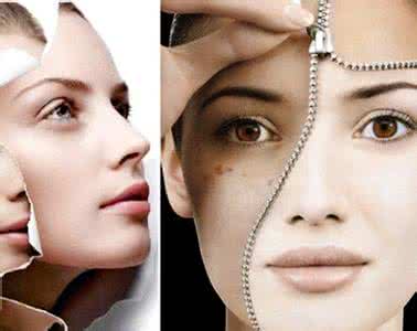 最好的祛斑美容整形 美肤祛斑 用整形祛斑的美肤攻略