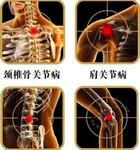脊髓空洞症治疗方法 颈肩腰腿痛治疗方法 出现颈肩腰腿疼,当心脊髓有空洞!